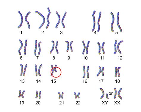 prader willi syndrome genetic testing